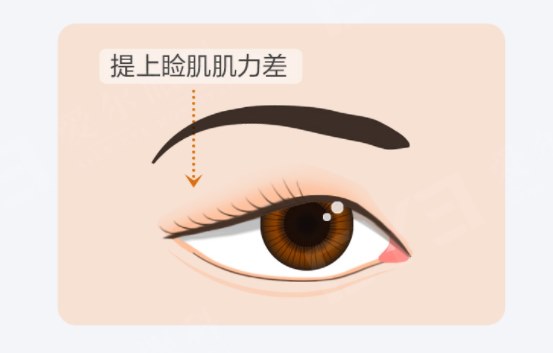圖片.png
